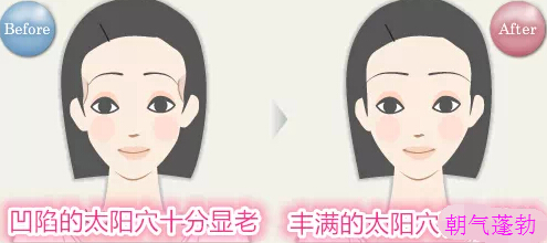 丰太阳穴